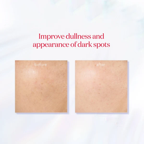 GenOptics InfinitAura Serum - Image 4